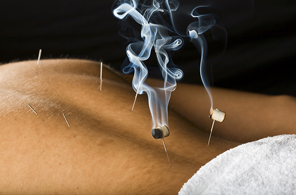back pain smoking natural healing bucks county pain management acupuncture New Hope PA cupping therapy